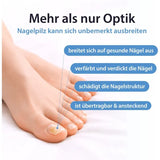 ACETOCAUSTIN Nail Fungus Pen for Nail Fungus Treatment 4 ml
