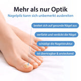 ACETOCAUSTIN nail fungus solution against nail fungus & for visibly better nails 5 ml