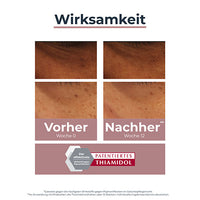 EUCERIN Anti-Pigment Eye Care Dark Circles
