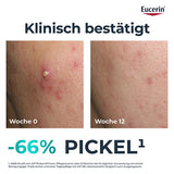 EUCERIN DermoPure Clinical Triple Action Cream
