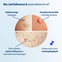 EVOLSIN Molluscum Contagiosum Solution