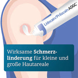 LIDOCAIN PRILOCAIN ADGC cream