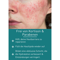 N1 Rosacea Cream