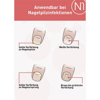 N1 nail fungus solution