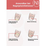 N1 nail fungus solution