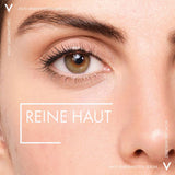 VICHY NORMADERM Anti-Blemish Serum